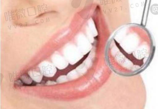 锆美全瓷牙是什么牙（彩锆全瓷牙是什么材料）(图1)